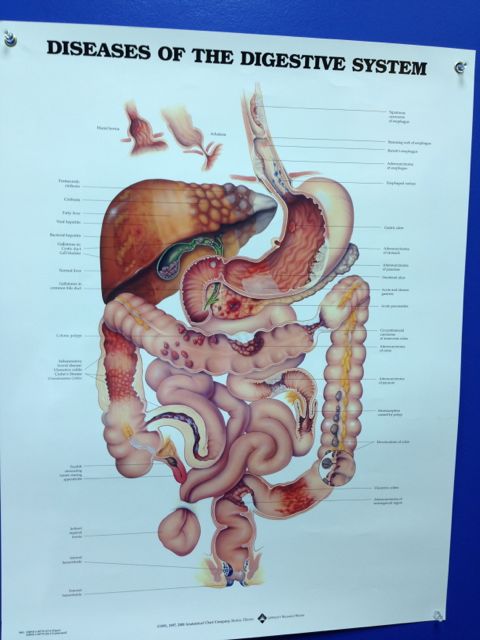 Diseases of the Digestive System chart