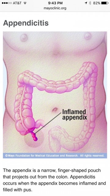 Lower right abdominal pain