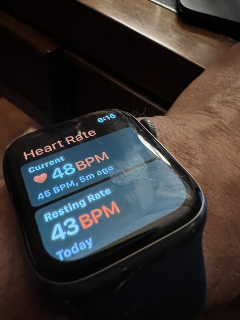 Apple Watch resting heart rate